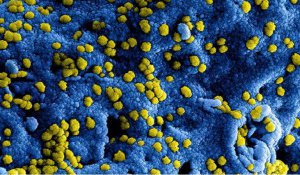 Corona virus
